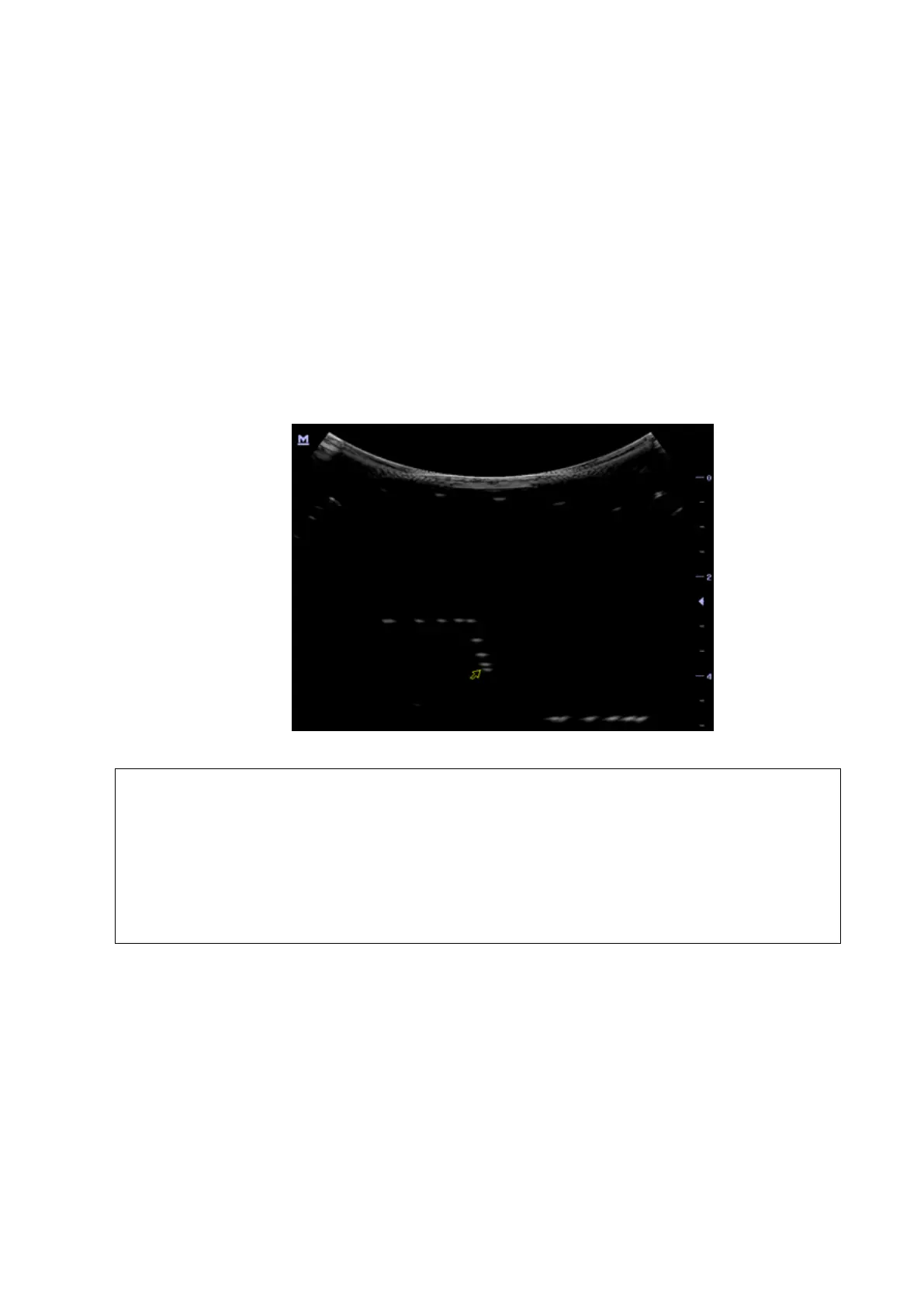 Page #87 background image