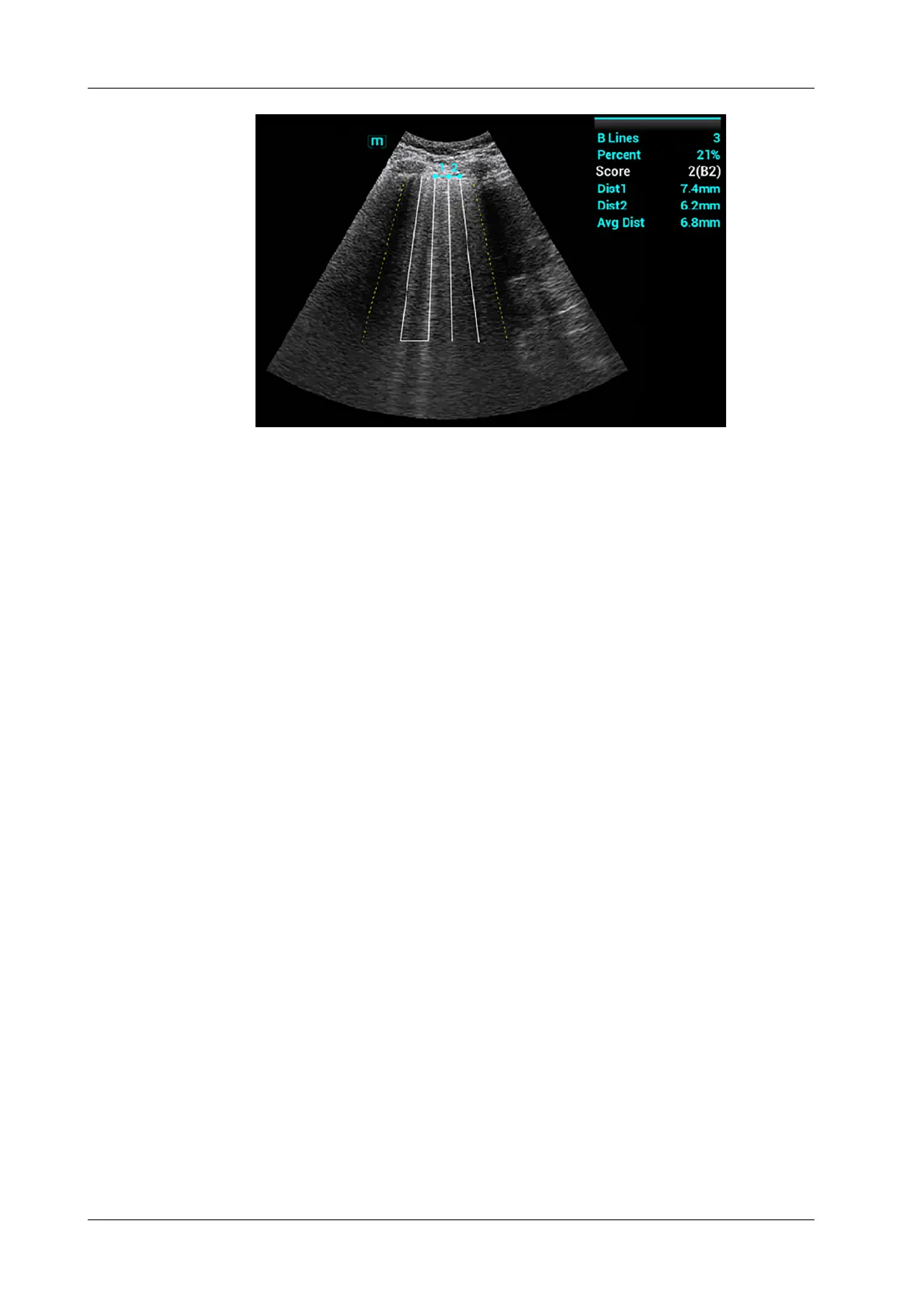 Page #126 background image
