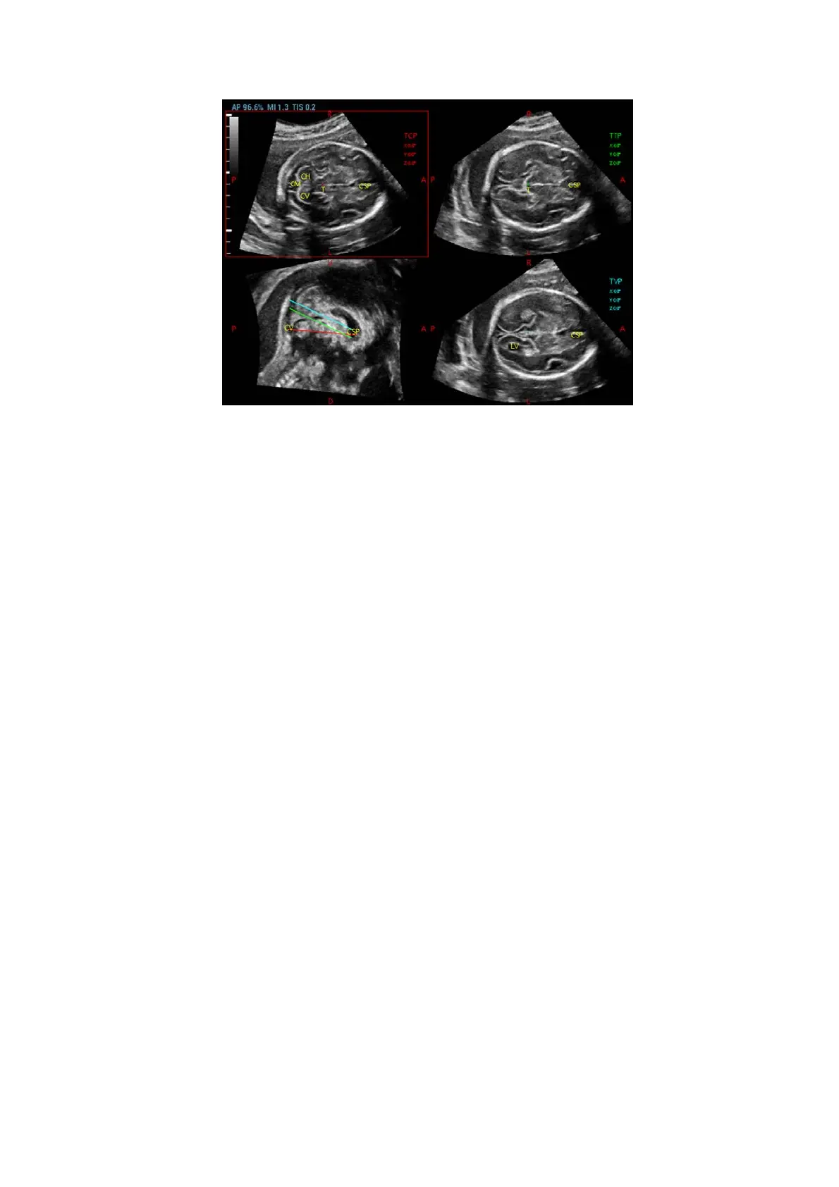 Page #151 background image