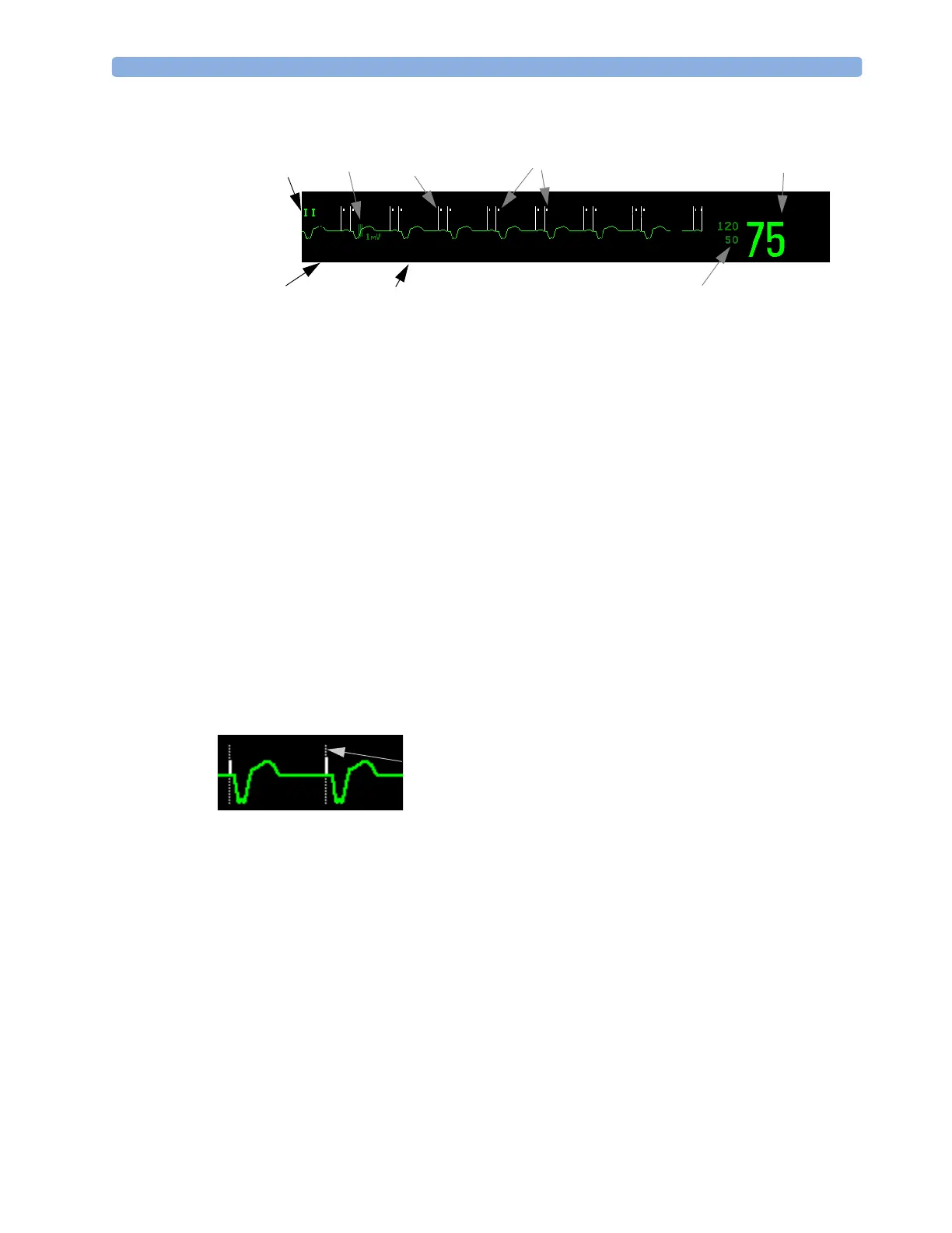 Page #111 background image