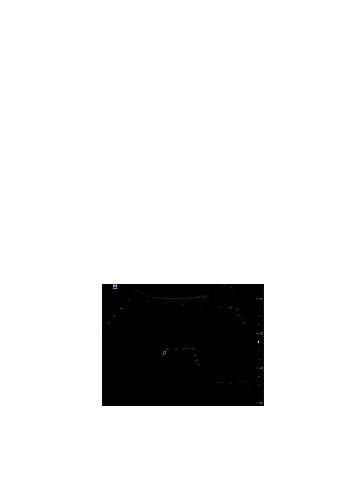 Page #86 background image