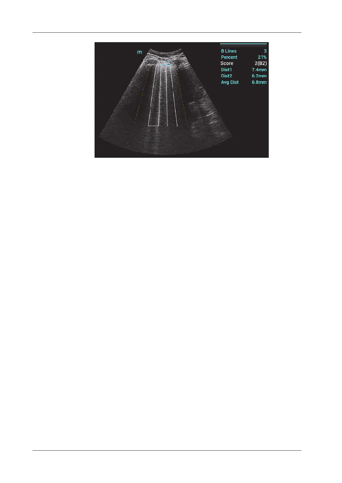 Page #102 background image
