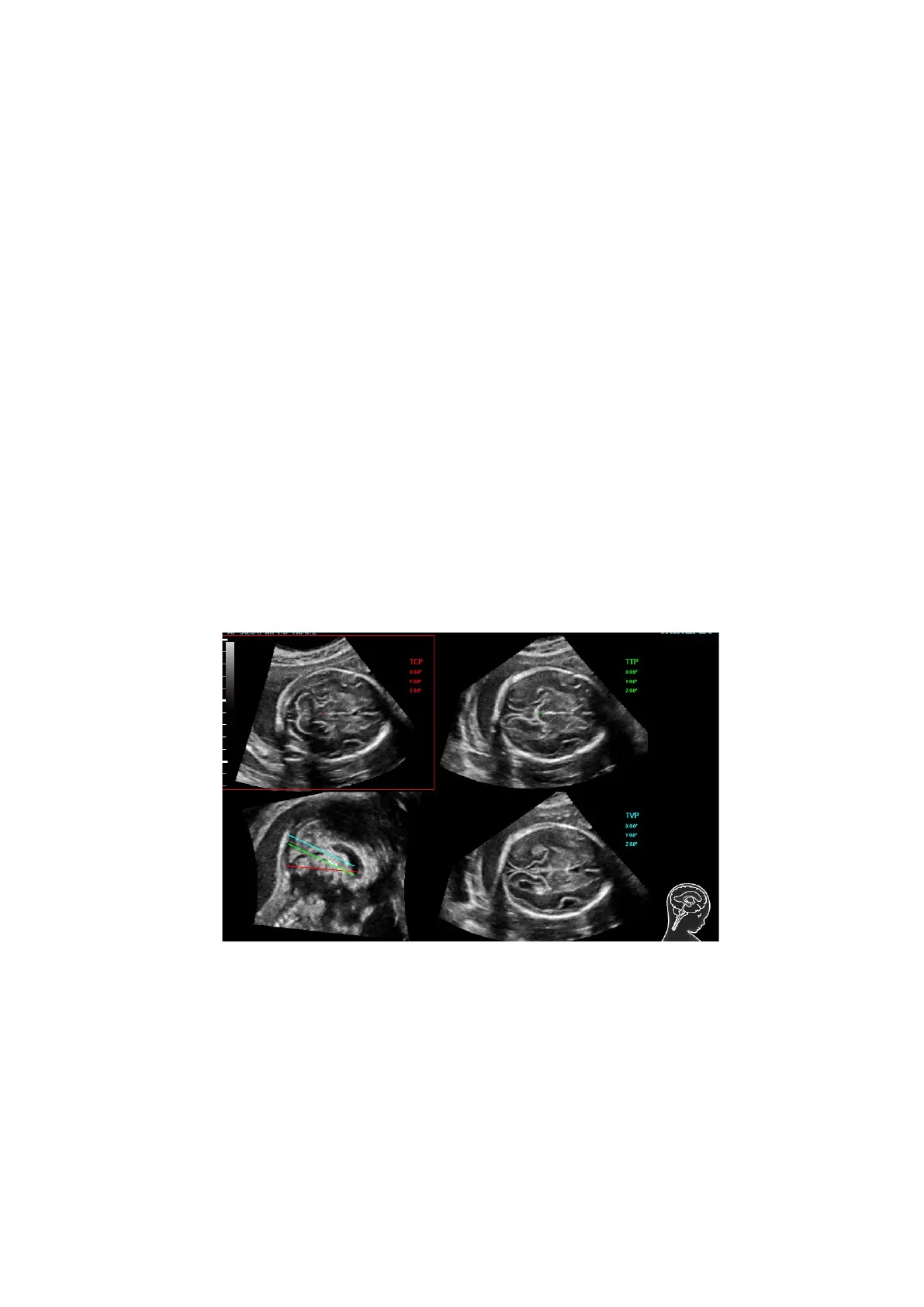 Page #146 background image