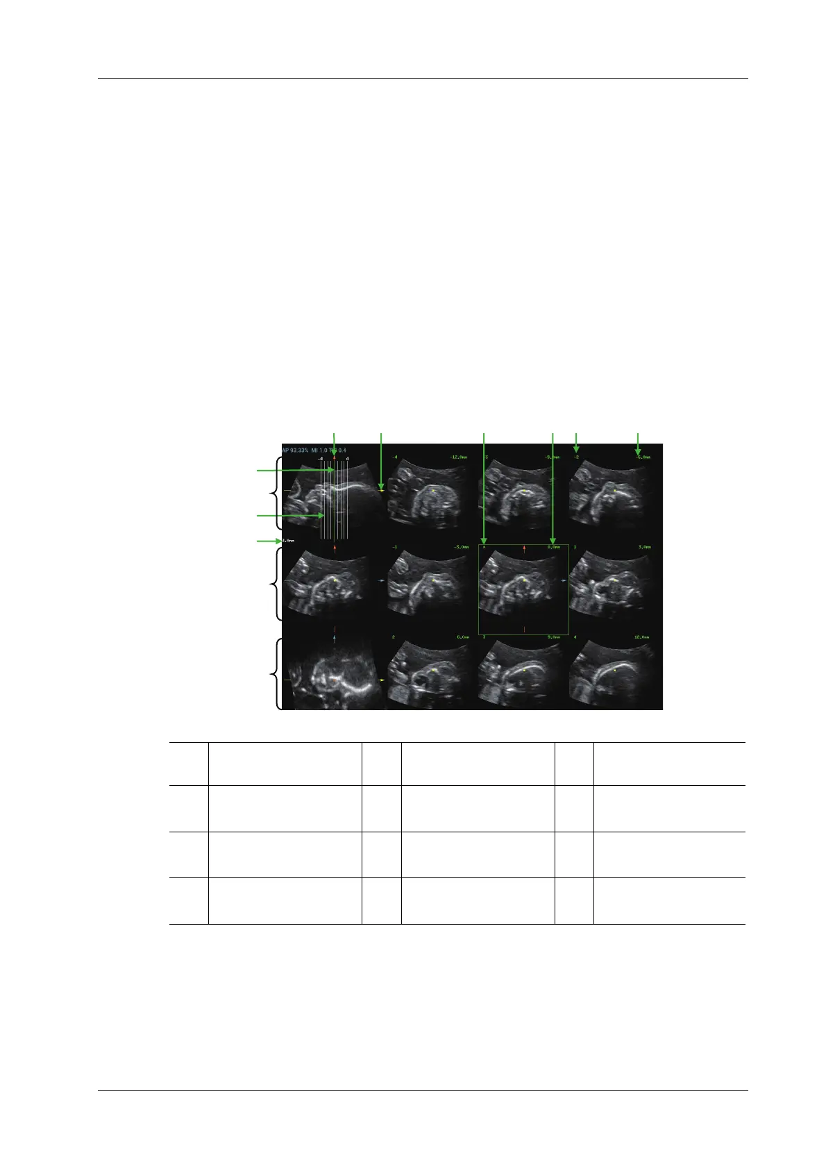 Page #225 background image