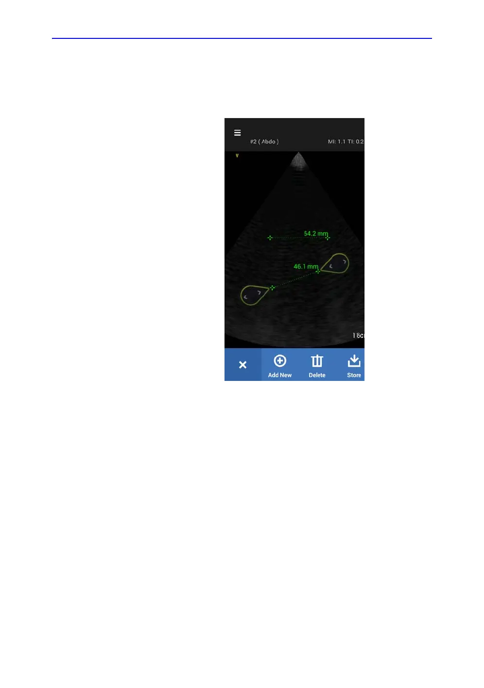 Page #155 background image