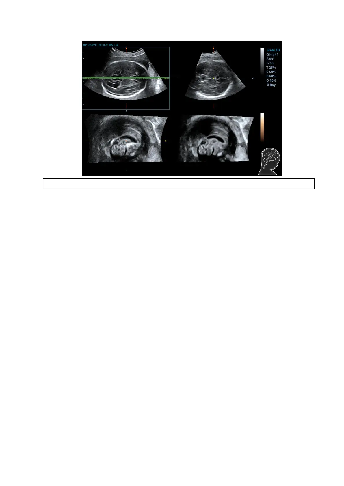 Page #151 background image