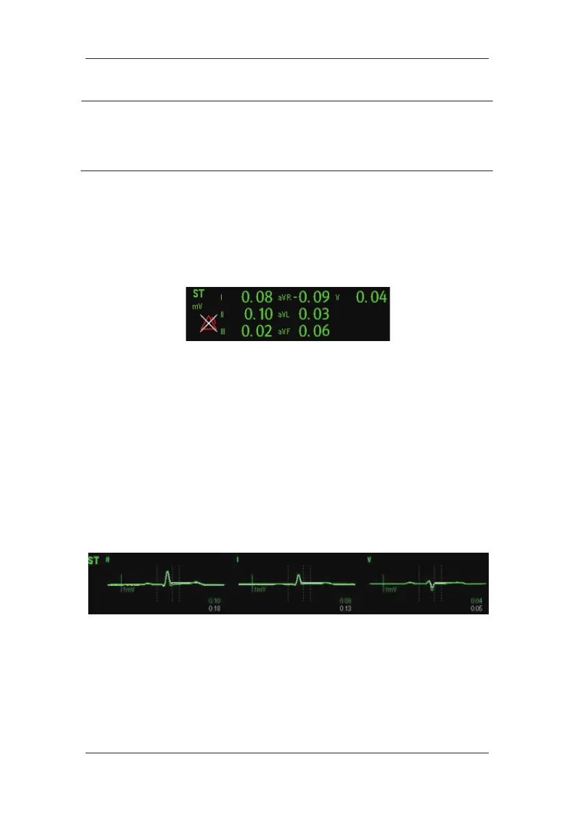 Page #102 background image