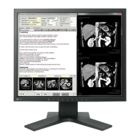Preview: Eizo RadiForce MX194