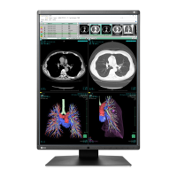 Preview: Eizo RadiForce RX360