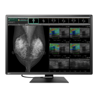 Preview: Eizo RadiForce RX1270
