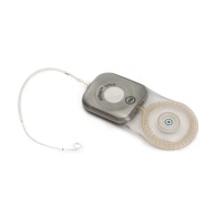 Preview: HiResolution Bionic Ear System
