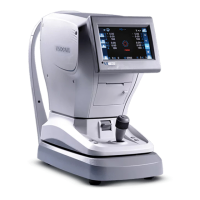 Preview: Visionix VX90