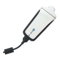 Preview: Signostics uscan