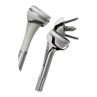 Preview: Synthes Delta Xtend