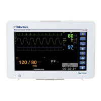 Preview: Mortara S12