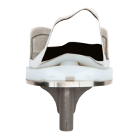 Preview: Smith & Nephew Syncera Anthem