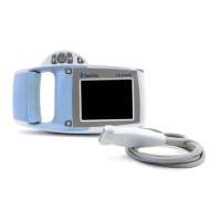 Preview: SonoSite iLook