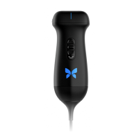 Preview: Butterfly Network iQ