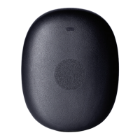 Preview: senseonics Eversense 365