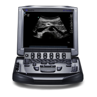 Preview: SonoSite M-Turbo