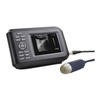 Preview: Portable Ultrasound V12