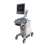 Preview: Siemens ACUSON X150