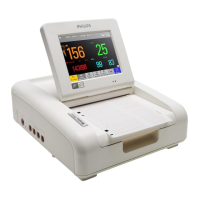 Preview: Philips Avalon FM20