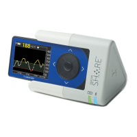 Preview: Dexcom Share