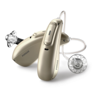 Preview: Phonak Marvel