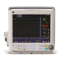 Preview: GE B20