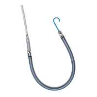 Preview: Abiomed Impella RP