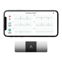 Preview: AliveCor Kardia Mobile