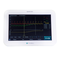 Preview: St. Jude Medical QUANTIEN