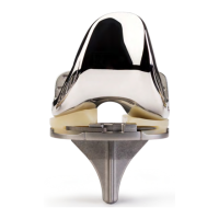 Preview: Vanguard  ID Total Knee