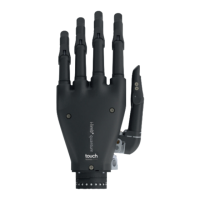Preview: Ossur i-Limb Quantum