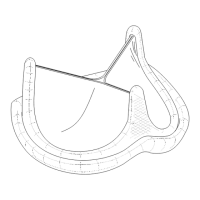 Preview: 3000TFX PERIMOUNT Magna Aortic