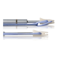 Preview: Synthes LUPINE BR Anchor