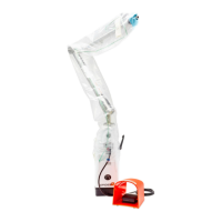 Preview: Smith & Nephew SPIDER2