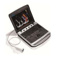 Preview: Chison SonoBook 8