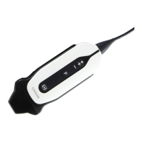 Preview: Chison SonoEye P3