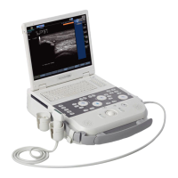 Preview: Siemens ACUSON P300
